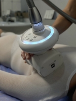 Picture of Face and body LPG endermologie massage